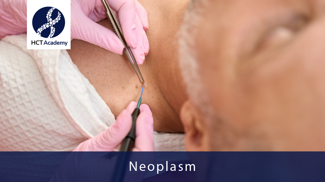 Neoplasm