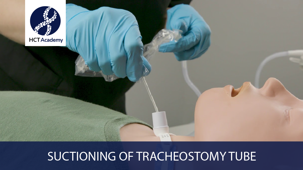 Suctioning of Tracheostomy Tube